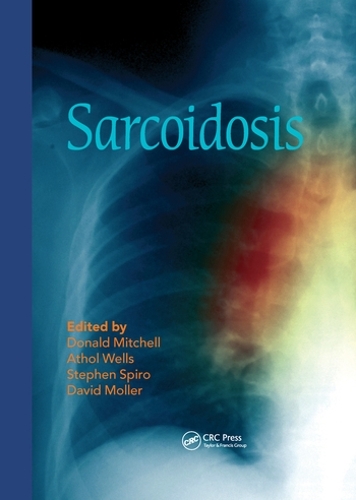 Бумажная книга «Sarcoidosis» - фото №1