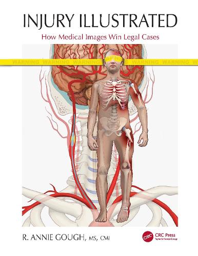 Бумажная книга «Injury Illustrated: How Medical Images Win Legal Cases», автор Р. Энни Гоф - фото №1