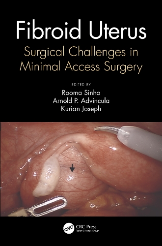 Бумажная книга «Fibroid Uterus: Surgical Challenges in Minimal Access Surgery» - фото №1