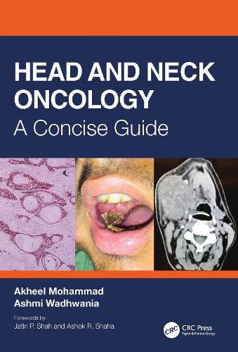 Бумажная книга «Head and Neck Oncology: A Concise Guide», авторов Акхил Мохаммад, Ашми Вадхвания - фото №1