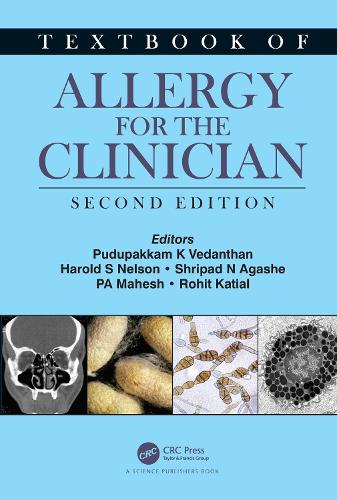 Паперова книга «Textbook of Allergy for the Clinician» - фото №1