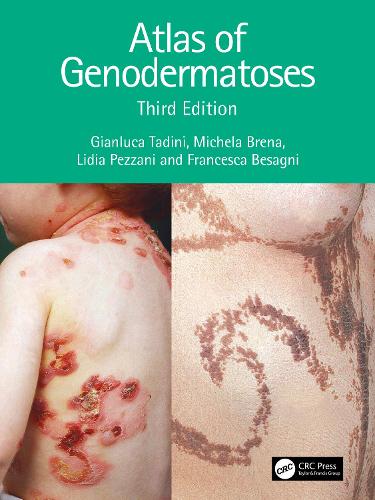 Паперова книга «Atlas of Genodermatoses», авторів Франческа Безаньї, Джанлука Тадіні, Лідія Пеццані, Мікела Брена - фото №1