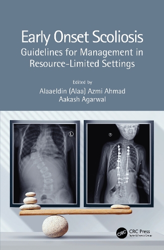 Бумажная книга «Early Onset Scoliosis: Guidelines for Management in Resource-Limited Settings» - фото №1