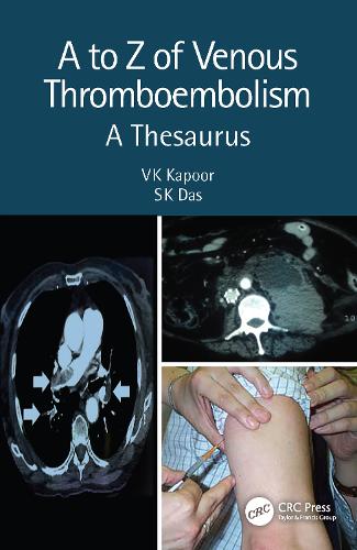 Бумажная книга «A to Z of Venous Thromboembolism: A Thesaurus», авторов СК Дас, В.К. Капур - фото №1