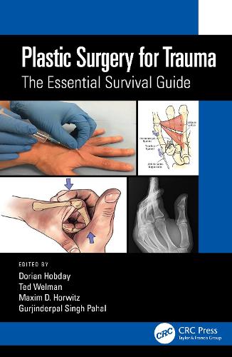 Бумажная книга «Plastic Surgery for Trauma: The Essential Survival Guide» - фото №1