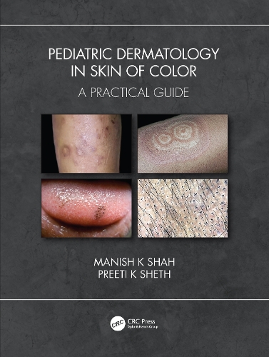 Бумажная книга «Pediatric Dermatology in Skin of Color: A Practical Guide», авторов Маниш К Шах, Прити К Шетх - фото №1