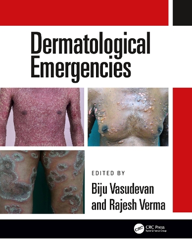 Паперова книга «Dermatological Emergencies» - фото №1