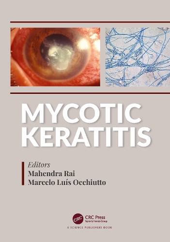 Бумажная книга «Mycotic Keratitis» - фото №1