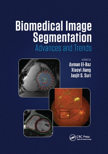 Паперова книга «Biomedical Image Segmentation: Advances and Trends» - фото №1