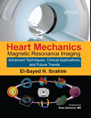 Паперова книга «Heart Mechanics: Magnetic Resonance Imaging�Advanced Techniques, Clinical Applications, and Future Trends» - фото №1