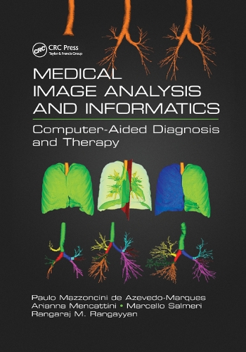 Бумажная книга «Medical Image Analysis and Informatics: Computer-Aided Diagnosis and Therapy» - фото №1