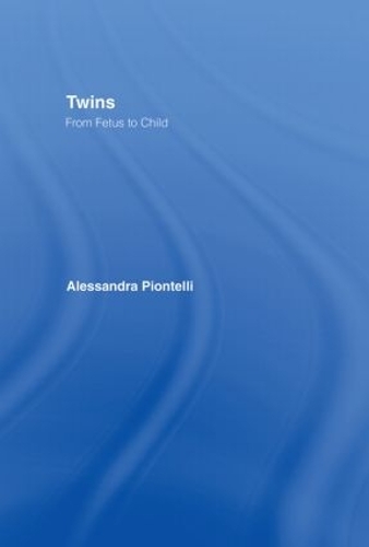 Бумажная книга «Twins - From Fetus to Child» - фото №1