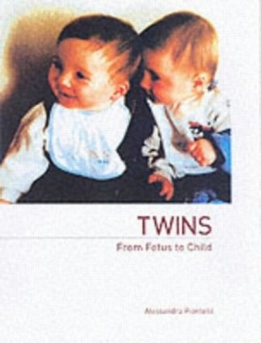 Бумажная книга «Twins - From Fetus to Child» - фото №1
