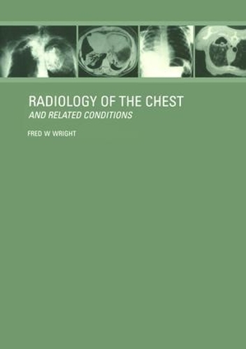 Паперова книга «Radiology of the Chest and Related Conditions», автор Ф. В. Райт - фото №1