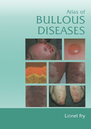 Бумажная книга «Atlas of Bullous Diseases», автор Лайонел Фрай - фото №1