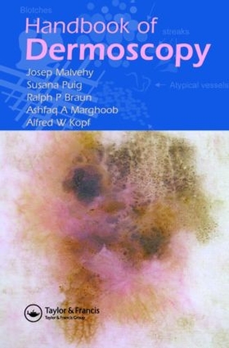 Паперова книга «Handbook of Dermoscopy», авторів Альфред В. Копф, Ашфак А. Маргхуб, Жосеп Мальвегі, Ральф П. Браун, Сусана Пуїг - фото №1