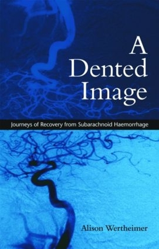 Бумажная книга «A Dented Image: Journeys of Recovery from Subarachnoid Haemorrhage», автор Элисон Вертхаймер - фото №1