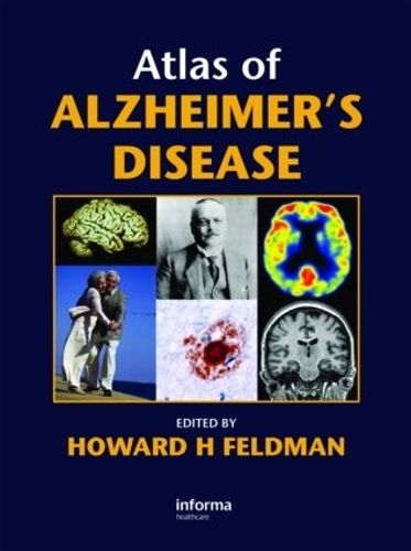 Бумажная книга «Atlas of Alzheimer's Disease», автор Говард Фельдман - фото №1