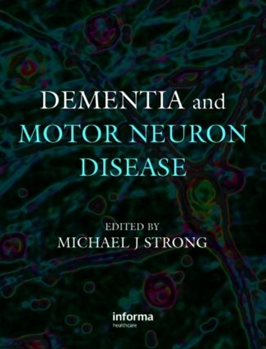 Паперова книга «Dementia and Motor Neuron Disease» - фото №1