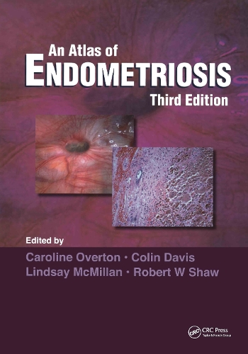 Бумажная книга «Atlas of Endometriosis», авторов Кэролайн Овертон, Колин Дэвис, Линдси Макмиллан, Роберт В. Шоу - фото №1