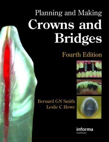 Паперова книга «Planning and Making Crowns and Bridges», авторів Бернард Г.Н. Сміт, Леслі К. Хоу - фото №1