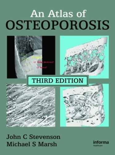 Паперова книга «An Atlas of Osteoporosis», авторів Джон К. Стівенсон, Майкл С. Марш - фото №1