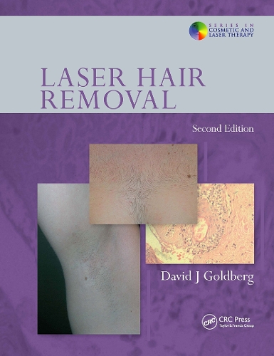 Бумажная книга «Laser Hair Removal» - фото №1