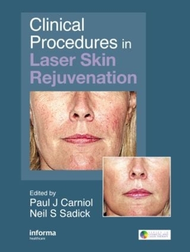 Бумажная книга «Clinical Procedures in Laser Skin Rejuvenation» - фото №1