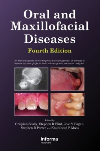 Паперова книга «Oral and Maxillofacial Diseases», авторів Кріспіан Скаллі, Стівен Флінт - фото №1