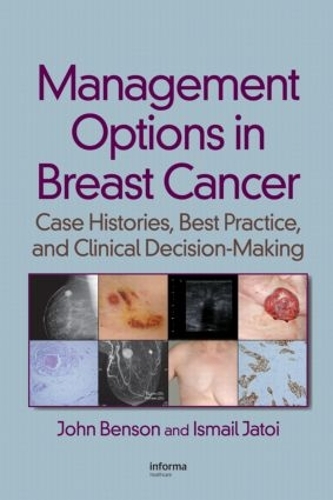 Бумажная книга «Management Options in Breast Cancer: Case Histories, Best Practice, and Clinical Decision-Making», авторов Исмаил Джатой, Джон Бенсон - фото №1