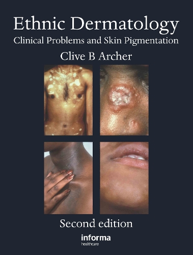 Бумажная книга «Ethnic Dermatology: Clinical Problems and Skin Pigmentation» - фото №1
