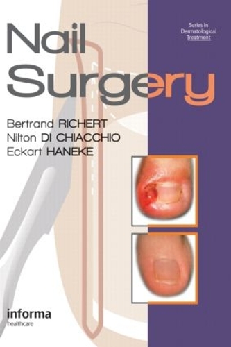 Паперова книга «Nail Surgery», авторів Бертран Ріхерт, Екарт Ханеке, Нілтон Ді Кьяккіо - фото №1