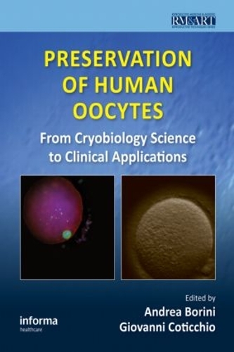 Паперова книга «Preservation of Human Oocytes: From Cryobiology Science to Clinical Applications» - фото №1