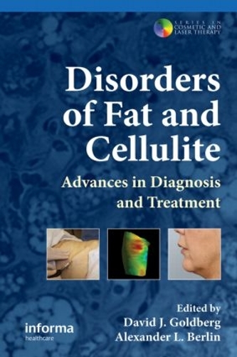 Бумажная книга «Disorders of Fat and Cellulite: Advances in Diagnosis and Treatment» - фото №1