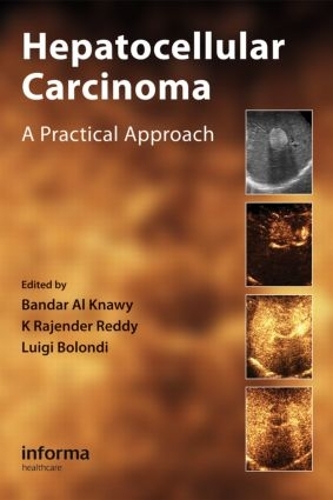Паперова книга «Hepatocellular Carcinoma: A Practical Approach» - фото №1
