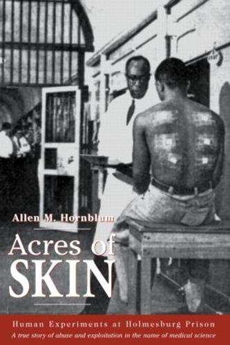 Паперова книга «Acres of Skin: Human Experiments at Holmesburg Prison», автор Аллен М. Хорнблюм - фото №1