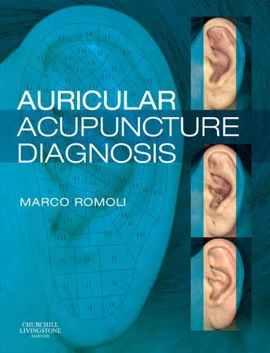 Бумажная книга «Auricular Acupuncture Diagnosis», автор Марко Ромоли - фото №1
