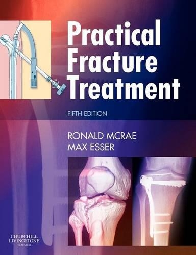 Бумажная книга «Practical Fracture Treatment», авторов Макс Эссер, Рональд Макрей - фото №1