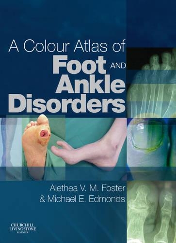 Бумажная книга «A Colour Atlas of Foot and Ankle Disorders», авторов Алетея В. М. Фостер, Майкл Э. Эдмондс - фото №1