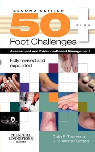 Паперова книга «50+ Foot Challenges: Assessment and Evidence-Based Management», авторів Колін Томсон, Дж. Н. Аластер Гібсон - фото №1