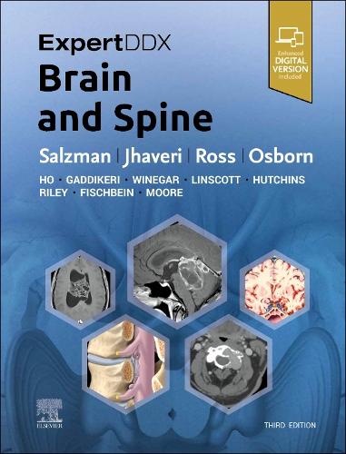 Бумажная книга «ExpertDDx: Brain and Spine», авторов Джеффри С. Росс, Карен Л. Зальцман, Мирал Д. Джхавери - фото №1