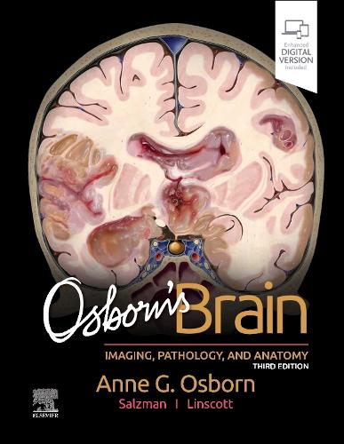 Бумажная книга «Osborn's Brain», авторов Энн Дж. Осборн, Карен Л. Зальцман, Люк Л. Линскотт - фото №1