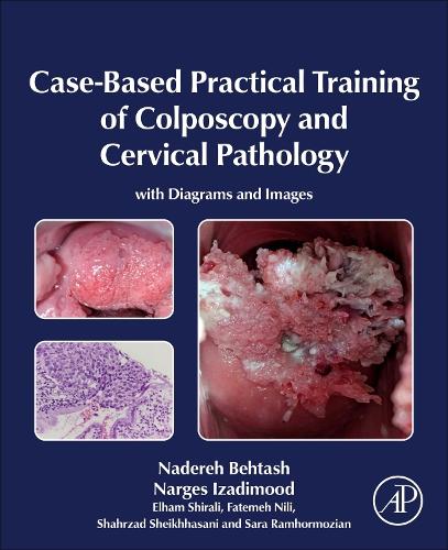 Бумажная книга «Case-Based Practical Training of Colposcopy and Cervical Pathology: With Diagrams and Images», авторов Эльхам Ширали, Фатемех Нили, Надерех Бехташ, Нарзес Изадимуд, Сара Рамхормозян, Шахрзад Шейххасани - фото №1