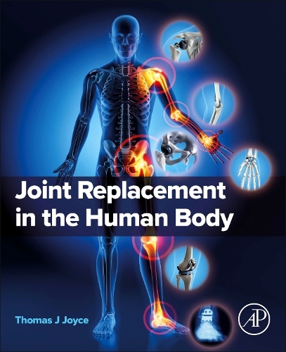 Бумажная книга «Joint Replacement in the Human Body», автор Томас Джойс - фото №1
