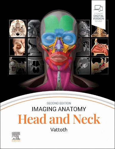 Паперова книга «Imaging Anatomy: Head and Neck», автор Суржит Ваттот - фото №1