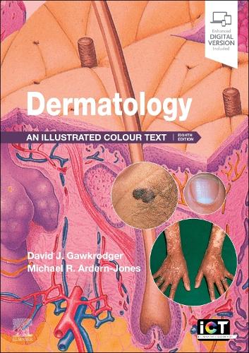 Паперова книга «Dermatology: An Illustrated Colour Text», авторів Девід Гавкроджер, Майкл Р. Ардерн-Джонс - фото №1