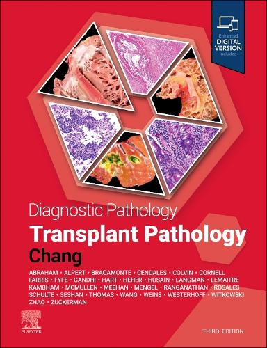 Бумажная книга «Diagnostic Pathology: Transplant Pathology», автор Энтони Чанг - фото №1