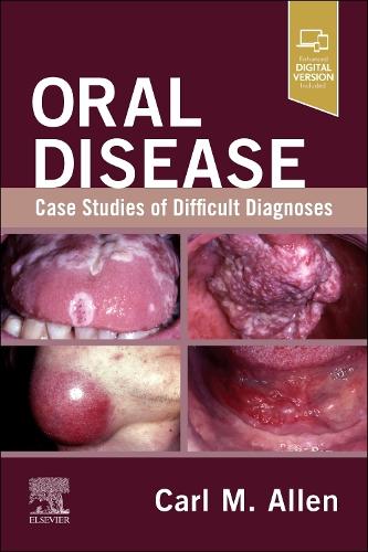 Бумажная книга «Oral Disease: Case Studies of Difficult Diagnoses: Case Studies of Difficult Diagnoses», автор Карл М. Аллен - фото №1