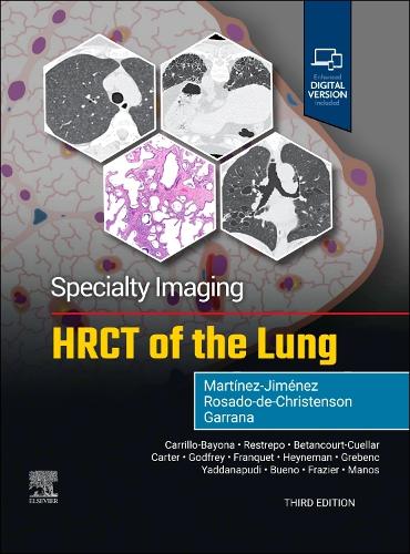 Бумажная книга «Specialty Imaging: HRCT of the Lung», авторов Мелисса Л. Росадо-де-Кристенсон, Сантьяго Мартинес-Хименес - фото №1