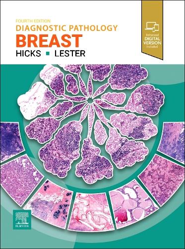 Паперова книга «Diagnostic Pathology: Breast», авторів Девід Г. Хікс, Сюзан К. Лестер - фото №1